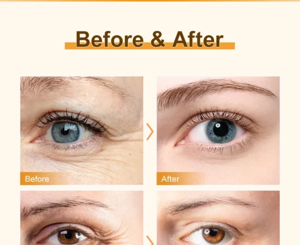 Anti‑Dark Circle Eye Cream – Peptides, Caffeine & Massage for Firmer, Brighter Eyes (15g) - Image 13