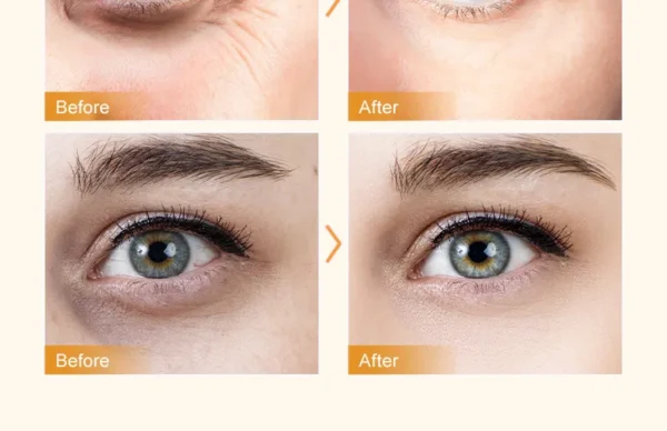 Anti‑Dark Circle Eye Cream – Peptides, Caffeine & Massage for Firmer, Brighter Eyes (15g) - Image 11