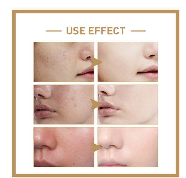 I'M FROM Rice Toner — Deep Hydration & Nourishment with the Power of Rice - Image 6